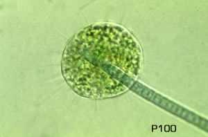 Nuclearia delicatula - An amoebae which  feeds exclusively  on blue-green  algae (Cyanobacteria). Cultures contain amoebic cells in various stages of ingesting  cyanobacterial filaments.