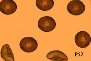 Arcella vulgaris - A typical testate amoebae which secretes a brown tectinous shell (test) with a central aperture through which the lobopodia emerge to capture bacteria and small  food  prey.